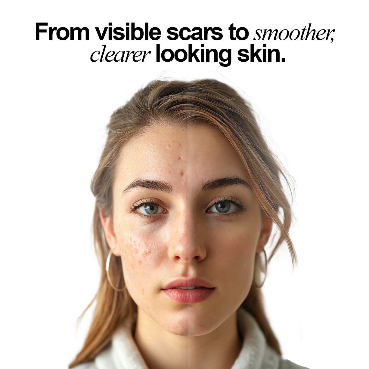 Silicone Scar Stick